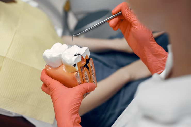 Model of a tooth at the dentist.Doctor shows the patient a tooth.Reception in the dentist's office<br />
