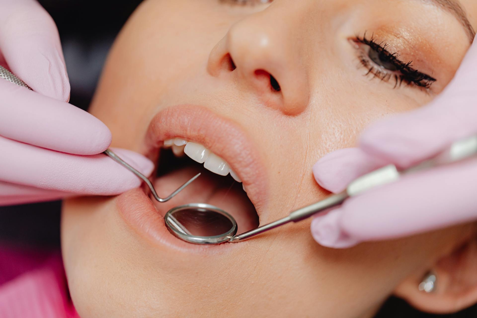 Close-Up Photo of a Woman Getting a Dental Check-Up<br />
